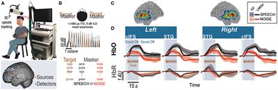 Hemodynamic Responses Link Individual Differences in Informational Masking to the Vicinity of Superior Temporal Gyrus